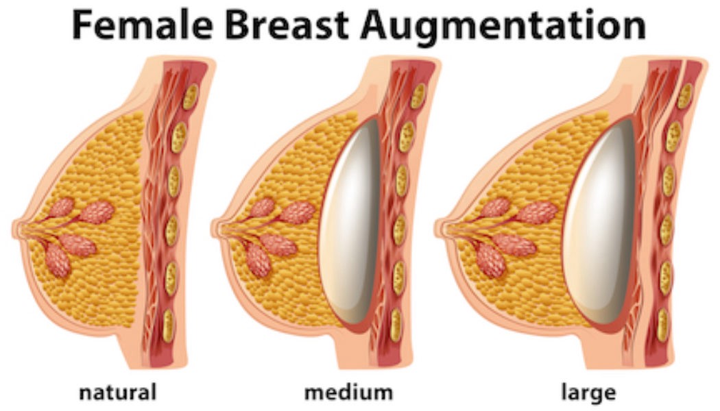 breast surgeon in hyderabad