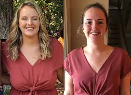 breast surgery in hyderabad