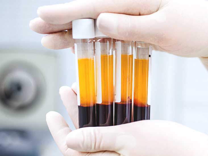 Platelet-Rich Plasma (PRP) - Aesthetic services
